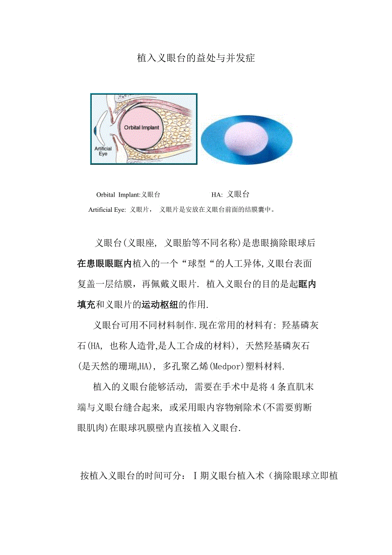 世界杯买球